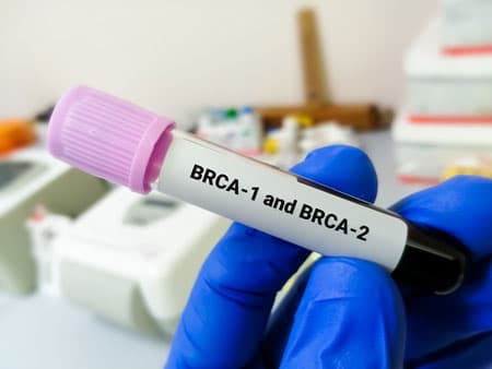 brca-test