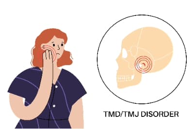 Women suffering from Temporomandibular Joint (TMJ) Pain
