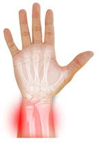 See-through image of hand showing bone structure.